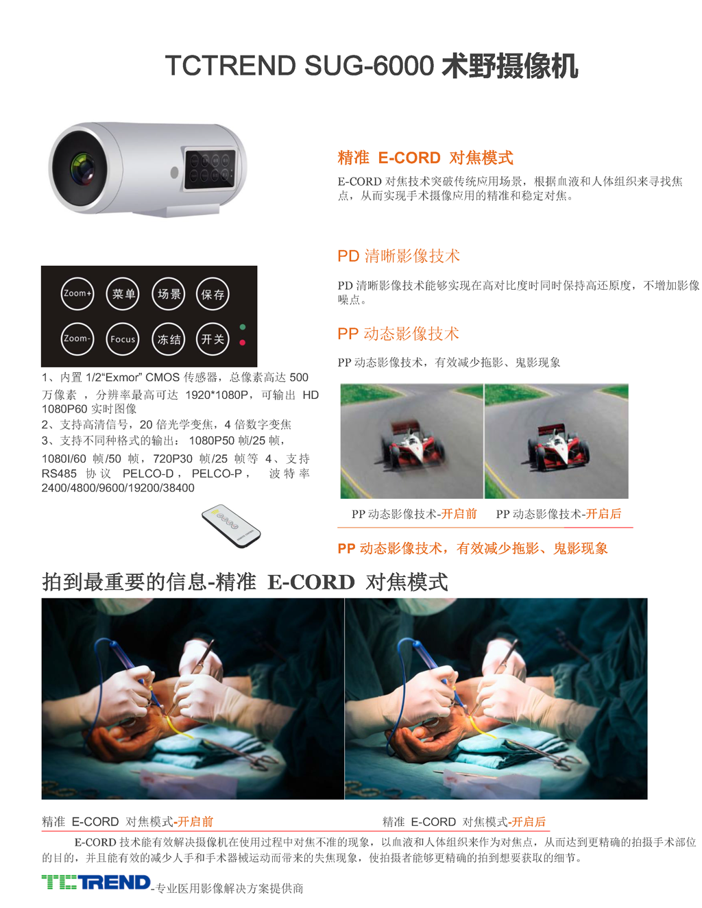 TCTREND SUG-6000術(shù)野攝像機(jī)(圖1)